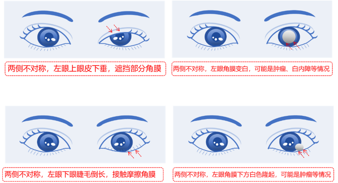 202503242341271500.Png